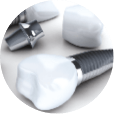 Dental Implant Crowns Kansas City